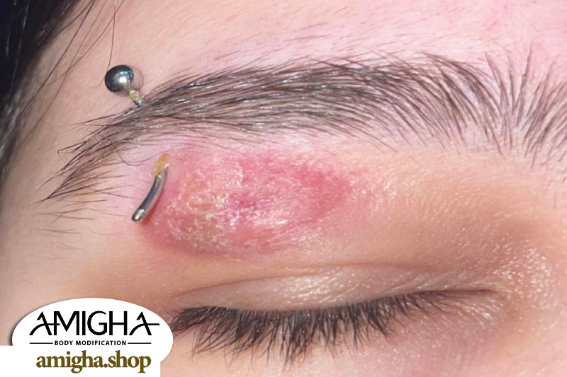 علائم عفونت پیرسینگ ابرو 