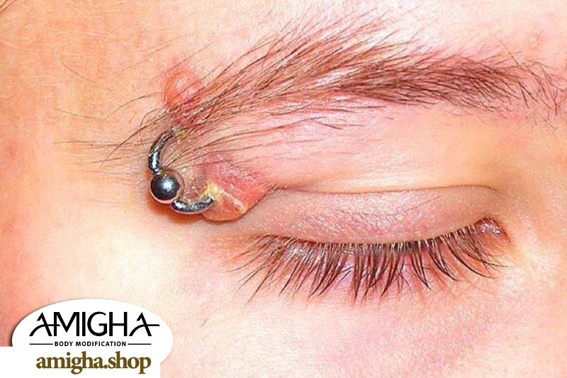 روش های پیشگیری از عفونت پیرسینگ ابرو 